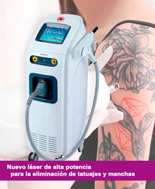 Cavitbell Centro Médico Estético máquina para quitar tatuajes